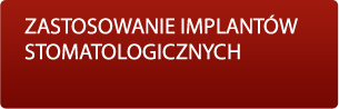 Zastosowanie Implantow Stomatologicznch